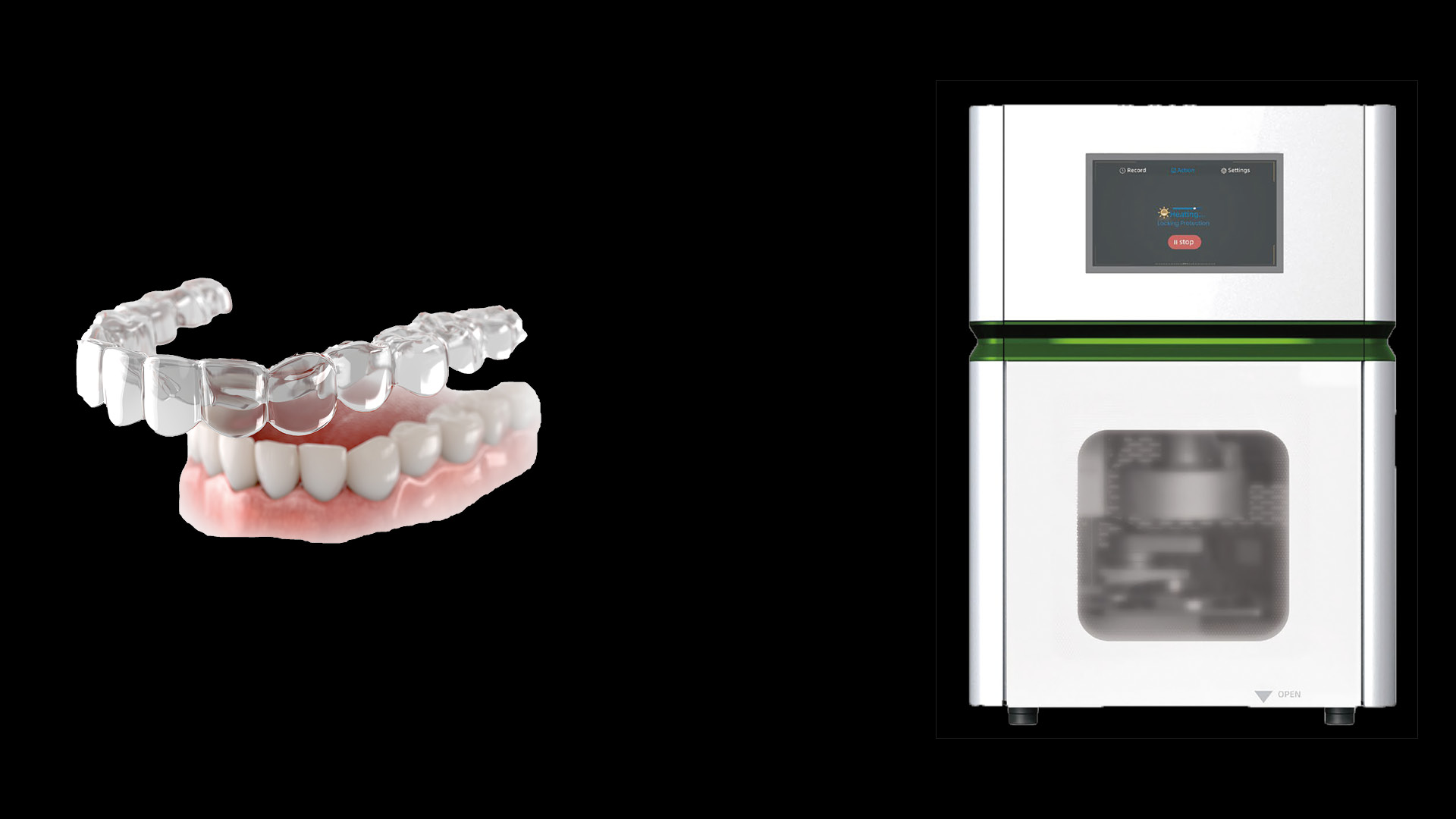 alignery ortodontyczne